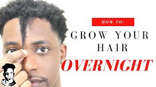 How To Grow Your Hair OVERNIGHT  WINSTONEE [upl. by Anestassia325]