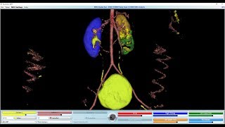 Radiographic Contrast Studies of the Urinary System [upl. by Resee901]