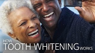 How Tooth Whitening Works [upl. by Redna]