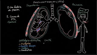 Pneumothorax  Docteur Synapse [upl. by Nauqan]