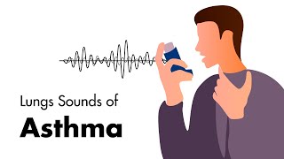 How to recognise and deal with an Asthma attack [upl. by Florin724]