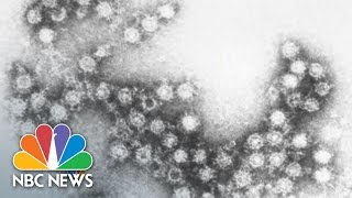 Enterovirus D68 What You Need To Know  NBC News [upl. by Aihsenad]