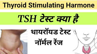 TSH Test in Hindi  Thyroid Stimulating Harmone  tsh report in hindi [upl. by Aprile]