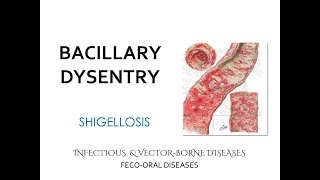 FecoOral diseases Bacillary Dysentery Shigellosis Lecture [upl. by Moira]