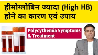 High hemoglobin Polycythemia Causes Symptoms Investigation and Treatment in Hindi [upl. by Gerhan]