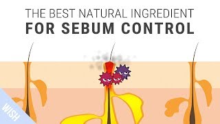 How To Control Excessive Sebum That Leads To Acne  SKINMISO Im A Helper [upl. by Ahsya945]