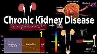 Chronic Kidney Disease Animation [upl. by Shepperd]