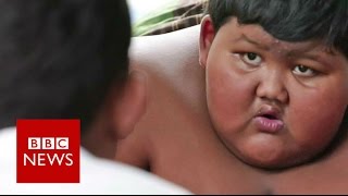 My 10yearold son weighs 188kg  BBC News [upl. by Ttehc]