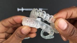 How to use Tooth Whitening Trays [upl. by Ardnua]