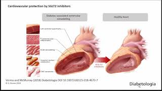 SGLT2 Inhibitors in Type 2 DM A Cardiorenal quotGameChangerquot [upl. by Adnov736]