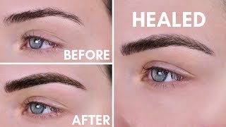 Microblading Experience  Before amp After  10 Day Healing Process [upl. by Eibrad]