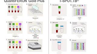 Interferon Gamma Release Assays IGRAs [upl. by Eenwat]