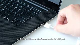 How to use Anykit NTE430 USB Ear Wax Camera with Windows PC [upl. by Ettenom784]