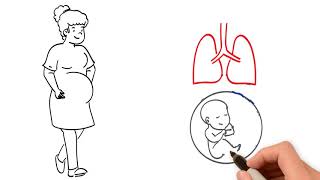 Pregnancy and the Respiratory System [upl. by Anircam]