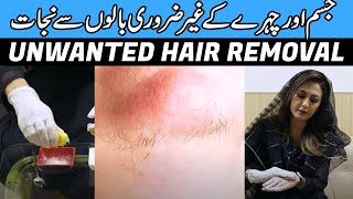 Natural Unwanted Hair Removal Remedy by Dr Umme Raheel [upl. by Rhys]