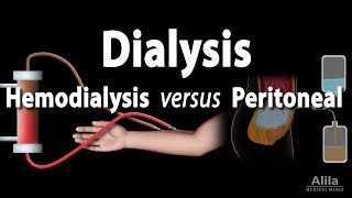 Renal Replacement Therapy Hemodialysis vs Peritoneal Dialysis Animation [upl. by Rego961]