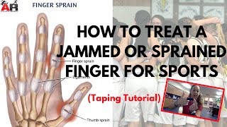 How To Treat a Jammed or Sprained Finger For Sports [upl. by Ariaek]