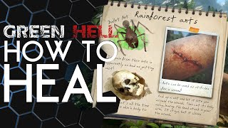 Green Hell  How to HEAL any condition [upl. by Canfield950]