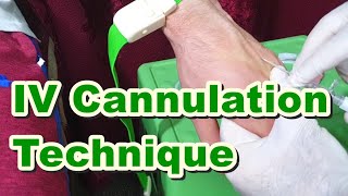 How to Insert IV Cannula  IV Cannulation Technique  Branula  Intravenous Catheter [upl. by Buddy]