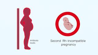 How Rh factor affects a pregnancy [upl. by Atelokin]