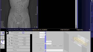 Normal Chest CT  using quotlung windowsquot [upl. by Nylavad]