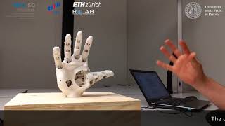 Myoelectric control of a 3D printed prosthetic hand [upl. by Pollock842]