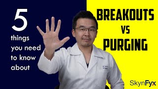 Breakout Vs Purging  5 things to know [upl. by Winson]