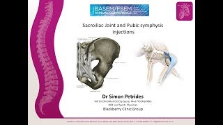 Sacroiliac Joint Injections and prolotherapy [upl. by Lipfert986]