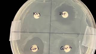 Bacterial Sensitivity to Garlic Results [upl. by Aw]