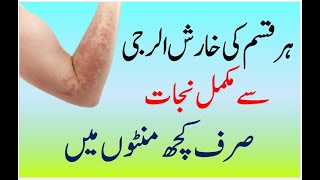 Skin Allergy Treatment At Home  Kharish Ka Ilaj In Urdu  Allergy Khatam Karne Ka Tarika [upl. by Atla712]