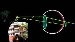 Human eye accommodation and near point Hindi  Human eye  Physics  Khan Academy [upl. by Aiceled646]