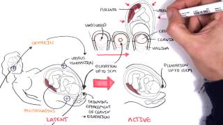 Obstetrics  Stages of Labour [upl. by Trygve]