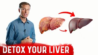 A Surprising Way To Cleanse Fatty Liver – Dr Berg On Liver Detoxification [upl. by Baugh391]