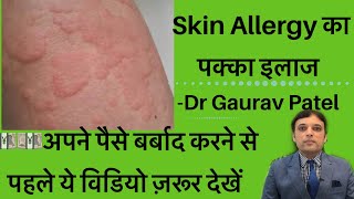 एलर्जी छींक नजला जुकाम खांसी का रामबाण इलाज  Allergy ka Ila Jukam Khansi Ka Ilaj Allergy Ka Ilaj [upl. by Kania]